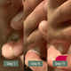 Clinical Antifungal Soap