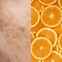 Fade stubborn  spots
